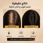 زيت MEIDIAN لتقوية الشعر